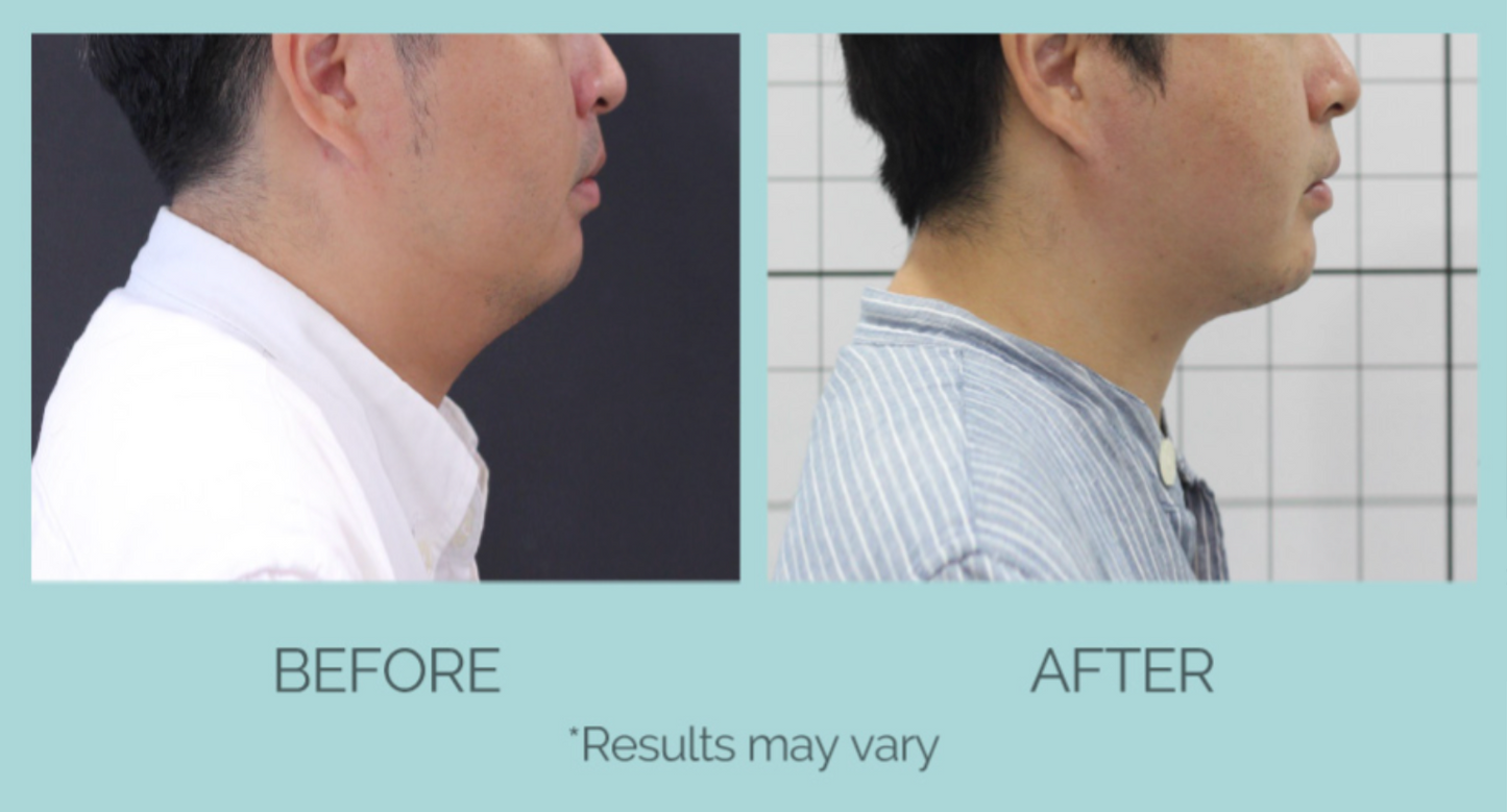 RFM - Full Face Package of 3