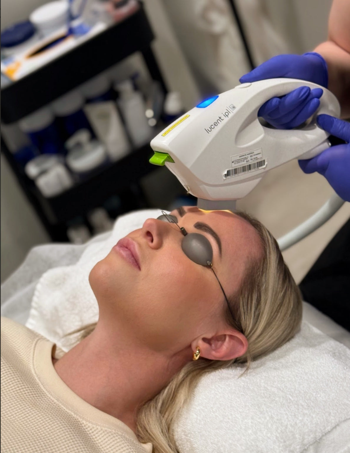 IPL - Intense Pulsed Light (Sundamage + Pigment) 3 Treatments