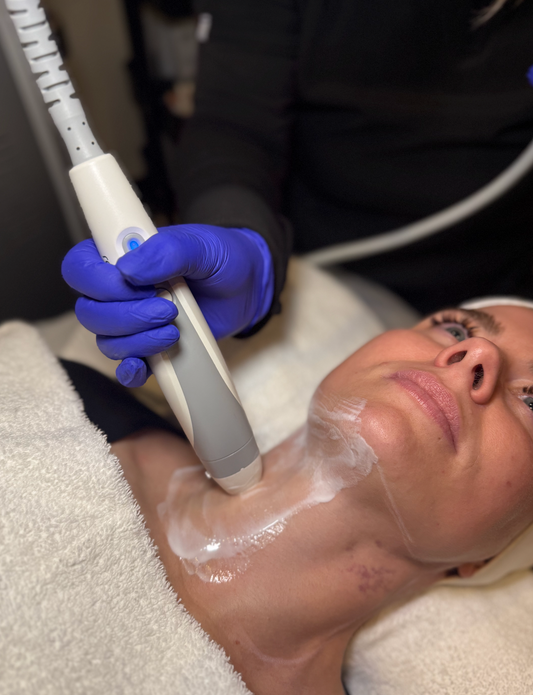 3 x Full face + Neck RF Refresh skin tightening treatments